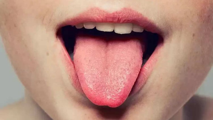 Health Tips- The color of your tongue tells the condition of your health, know the complete details